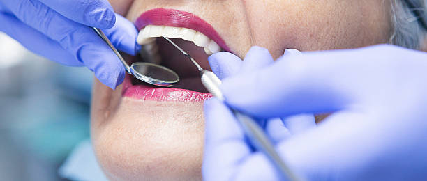 Best Emergency Dentist for Lost Fillings or Crowns in Head Of The Harbor, NY